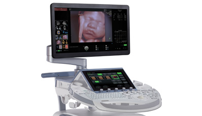 Nackentransparenz (NT) Screening  11. bis 14. Schwangerschaftswochen (SSW) Ultraschall